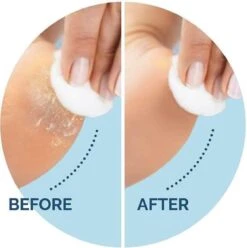 Scholl Velvet Smooth Voetvijl Wet & Dry - Starter - 1 Stuk -Cosmetica Winkel 1196x1200 2