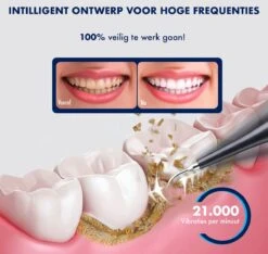 DynaBright Elektrische Tandsteen Verwijderaar - 5 Standen - 5 Delig - Incl. Professionele Tandarts Set - Tandplak - Zwart - Tong Schraper - USB - Tand Verzorging -Cosmetica Winkel 1200x1136 4