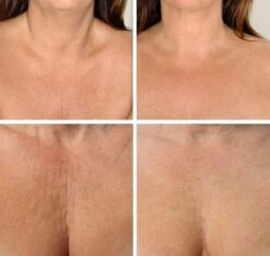 Simia™ Anti Rimpel Beauty Pads - Decolleté Large T Shape Set (2 Stuks) - Herbruikbaar Anti Aging Siliconen Pad Tegen Lijntjes En Slaaprimpels 9 Simia™ Anti Rimpel Beauty Pads - Decolleté Large T Shape Set (2 Stuks) - Herbruikbaar Anti Aging Siliconen Pad Tegen Lijntjes En Slaaprimpels -Cosmetica Winkel 1200x1139