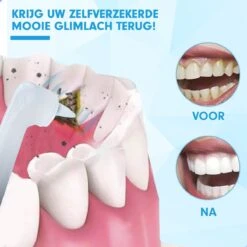 DEN-T® PRO P350 Elektrische Tandenpolijster - Wit - 5 Standen - 5 Opzetstukken - Polijstmachine - Polijstset - Tanden Polijsten - -Cosmetica Winkel 1200x1200 336