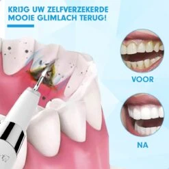 DEN-T® PRO U500 - Elektrische Sonische Tandsteen Verwijderaar - Wit -Cosmetica Winkel 1200x1200 366