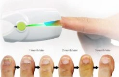 Anti Schimmelnagel Kalknagel Laserapparaat Om Zelf Te Behandelen, Veilig, Effectief, Snel En Pijnloos, Koude Laser Behandeling Voor Thuisgebruik, Voor Tenen En Vingers. Oplaadbaar. 10 Anti Schimmelnagel Kalknagel Laserapparaat Om Zelf Te Behandelen, Veilig, Effectief, Snel En Pijnloos, Koude Laser Behandeling Voor Thuisgebruik, Voor Tenen En Vingers. Oplaadbaar. -Cosmetica Winkel 1200x774